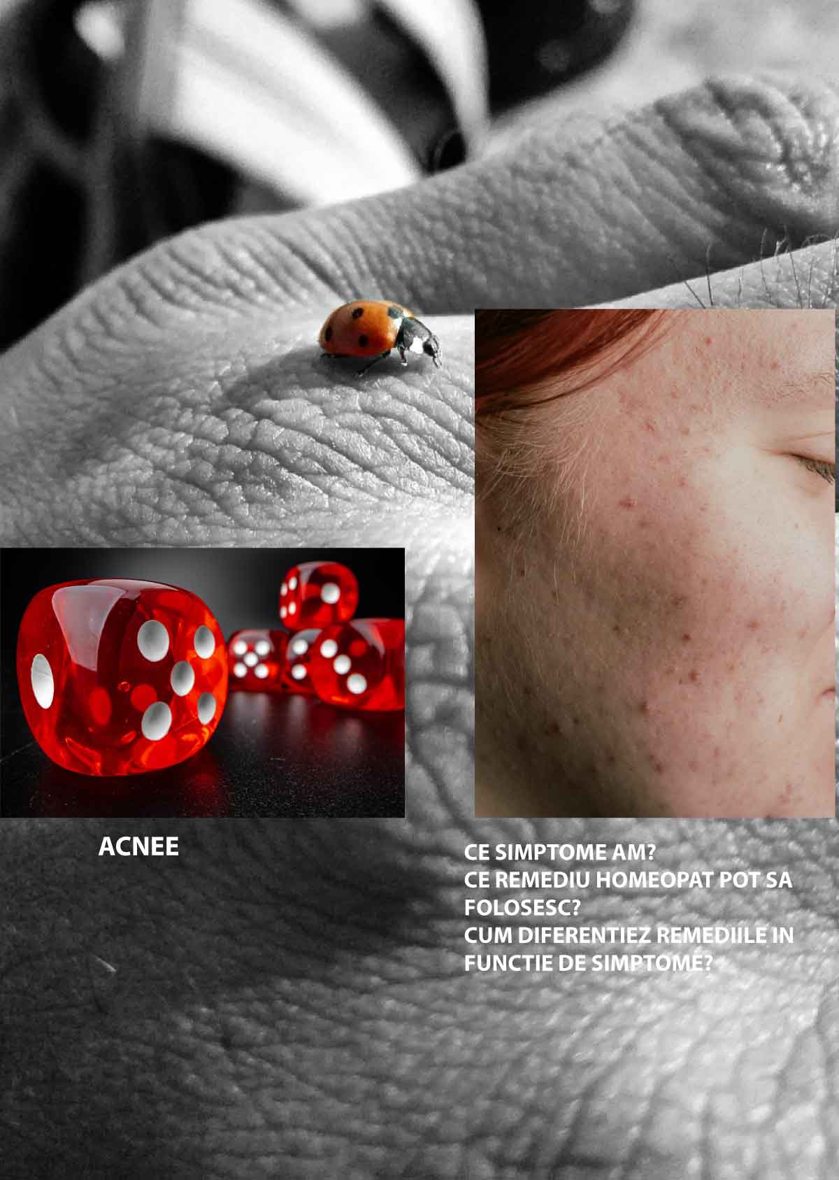 Ghid Homeopatic - Acnee